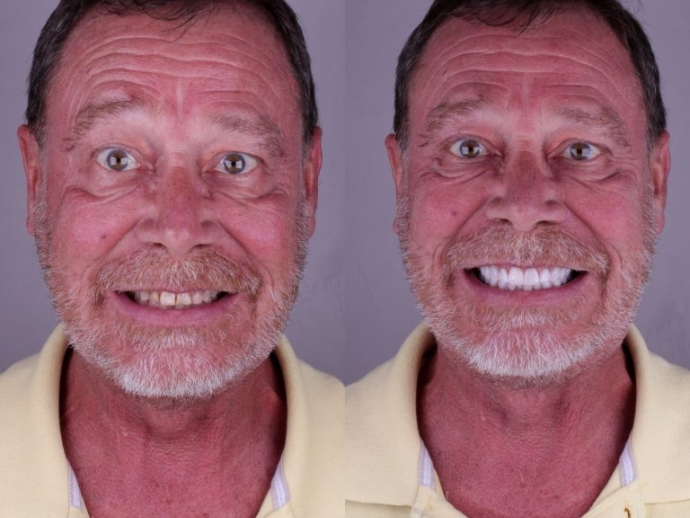 Dentist in Rio de Janeiro: Advanced Aesthetic Dentistry at Irio Odonto