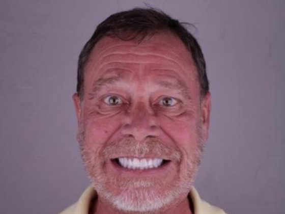 Dentista na barra da tijuca - Irioodonto