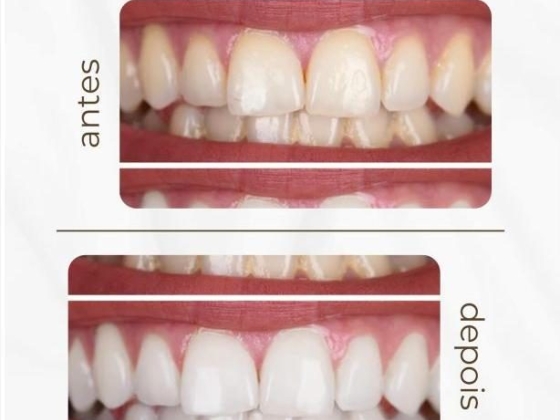Foco Odonto - Dentista no Rio Comprido