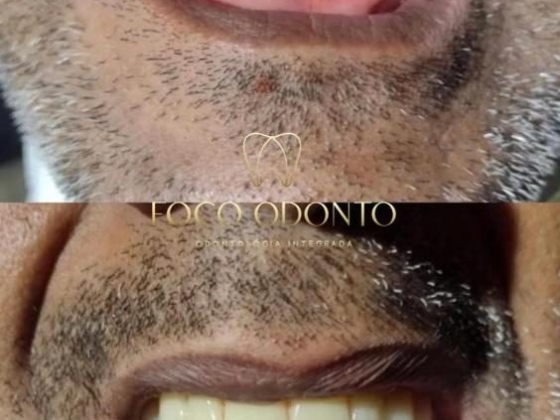 Foco Odonto - Dentista no Rio Comprido