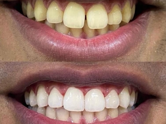Foco Odonto - Dentista no Rio Comprido