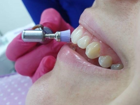 Dra Meirielle Azevedo – Dentista em Volta Redonda