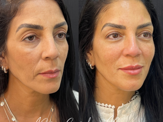Dra. Carolina Russo - Harmonização facial e corporal 