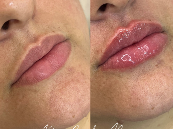 Dra. Carolina Russo - Harmonização facial e corporal 