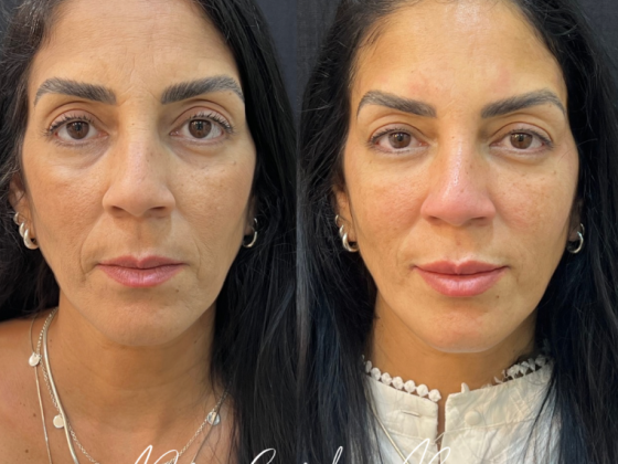 Dra. Carolina Russo - Harmonização facial e corporal 